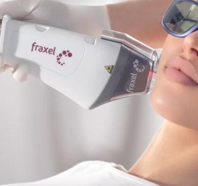 Fraxel Laser Singapore