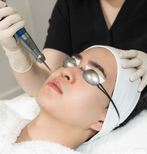 Non-Ablative Laser Singapore
