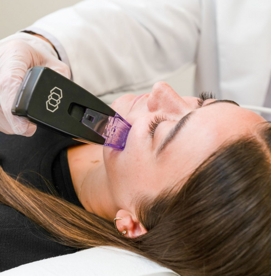 RF Microneedling Singapore