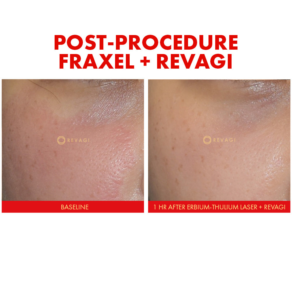 The Recombinant Collagen Serum