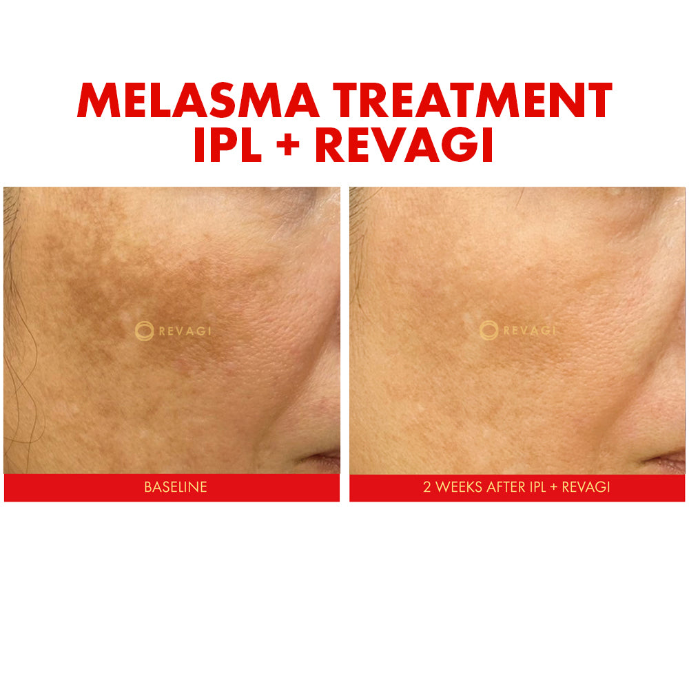 The Recombinant Collagen Serum