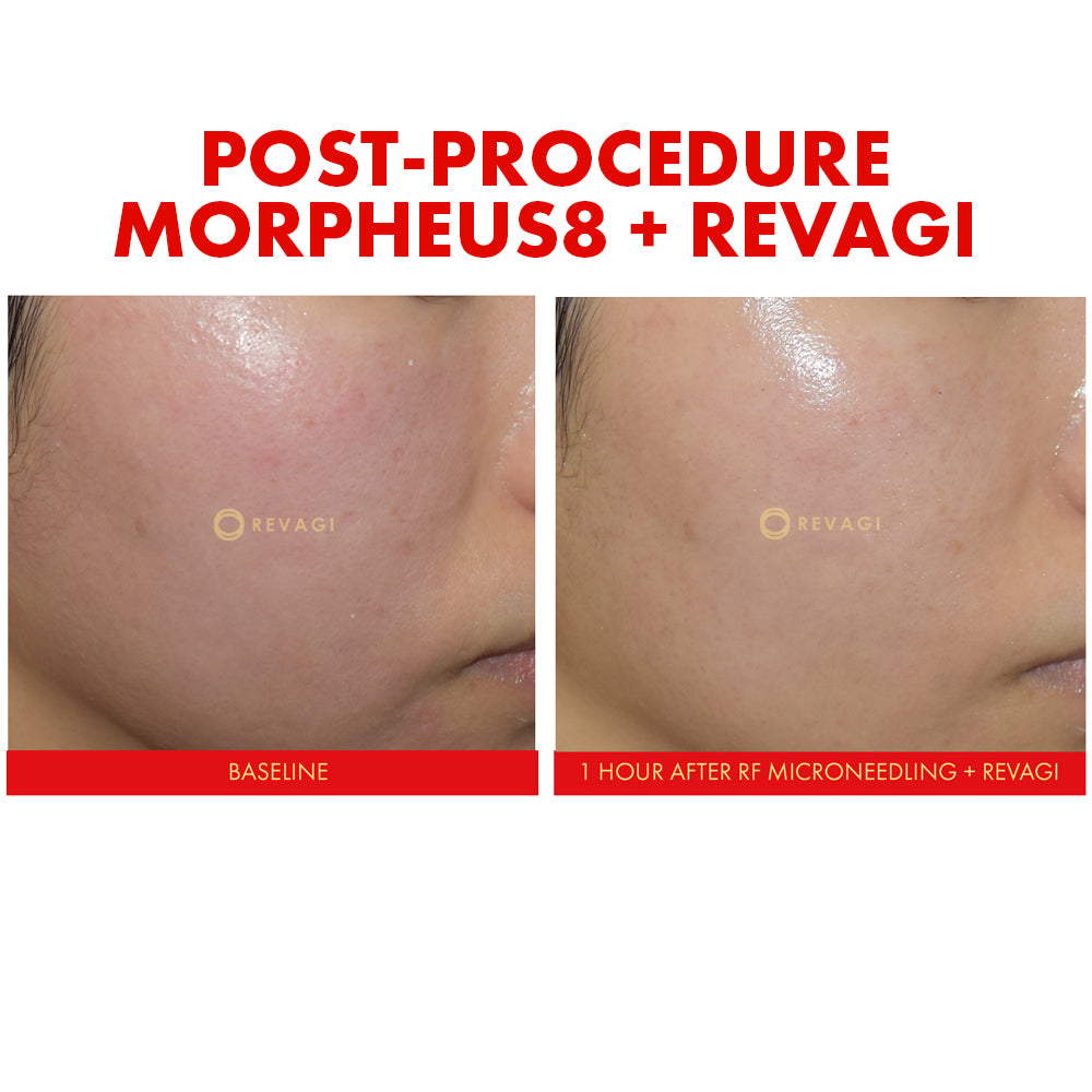 The Recombinant Collagen Serum