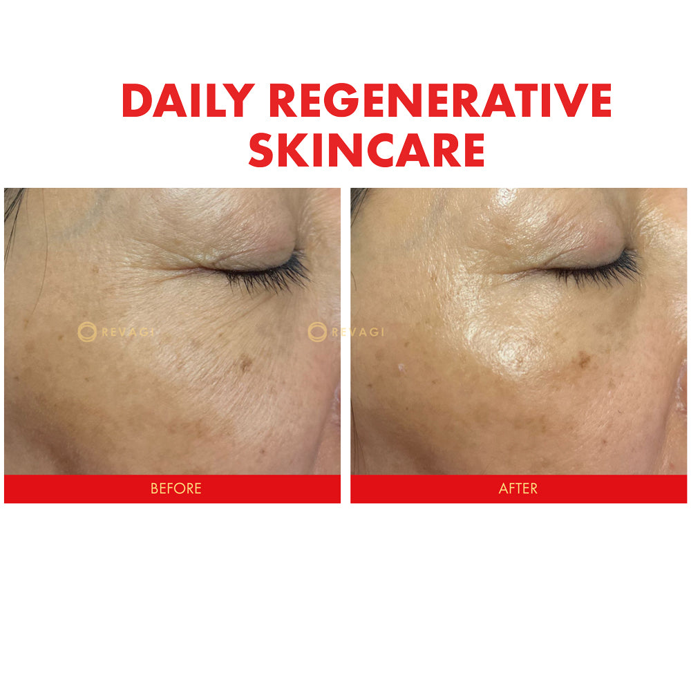 The Recombinant Collagen Serum