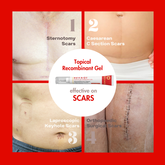 TOPICAL RECOMBINANT GEL